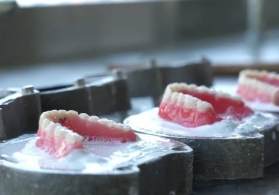 Five tips for choosing the right denture lab