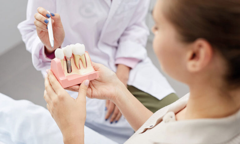 What Are The Prices Of Dental Implants