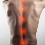 Is Spinal Cord Stimulation Right for You?