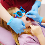All that You Should Know about Fluoride Treatment for Kids